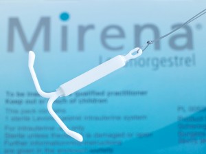 Mirena IUD