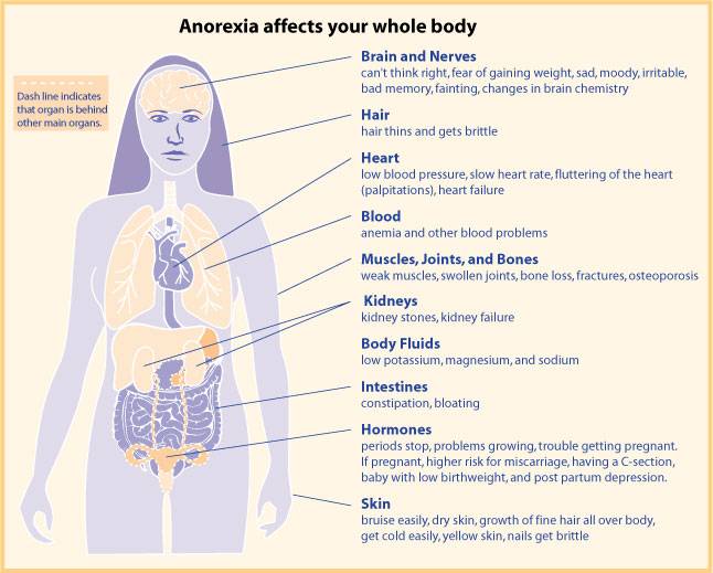 Anorexia and health
