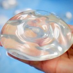 Silicone-filled Breast Implant