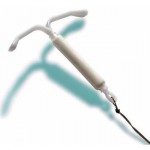 IUD