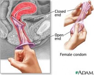 Female condom