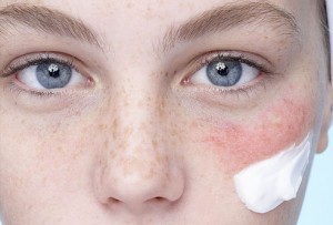 Skin cleansing medicated