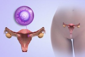 Implantation - beginning of pregnancy
