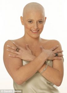 Symptoms of breast cancer