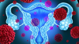 Fibroids treatment