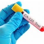 Tumor markers for ovarian cancer