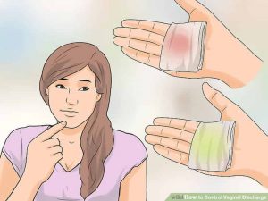 Vaginal discharge color