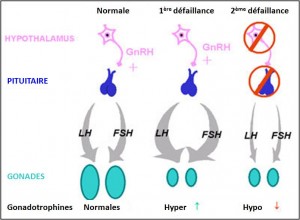 Hypogonadisme hypogonadotrophique