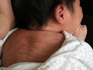 Le bébé asiatique le plus poilu