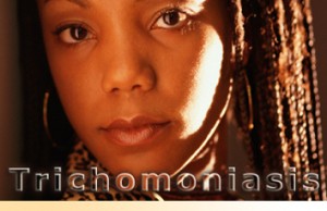 La TRICHOMONIASE transmise sexuellement