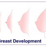Breast development