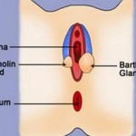 Bartholin Cyst causes and symptoms