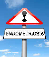 What is Endometriosis?