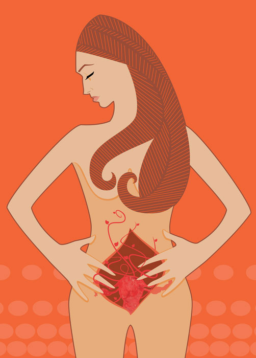 Endometriosis (general information)