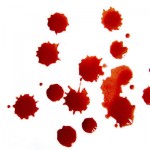 Light brown spotting