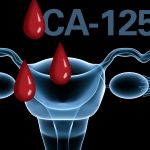 Tumor marker CA-125