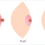 Normal, flat and inverted nipple