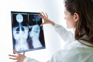 False mammogram results