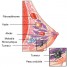 Maladies des seins