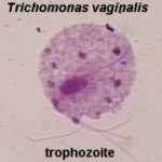 Trichomonas vaginalis