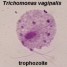 Trichomoniase : Pertes vaginales