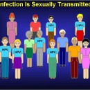 Transmission du HPV et les symptômes du HPV