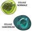 Cellules cancéreuses