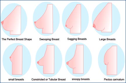 Formes de sein